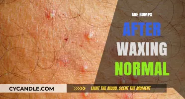 Post-Waxing Bumps: Understanding and Managing Skin Reactions