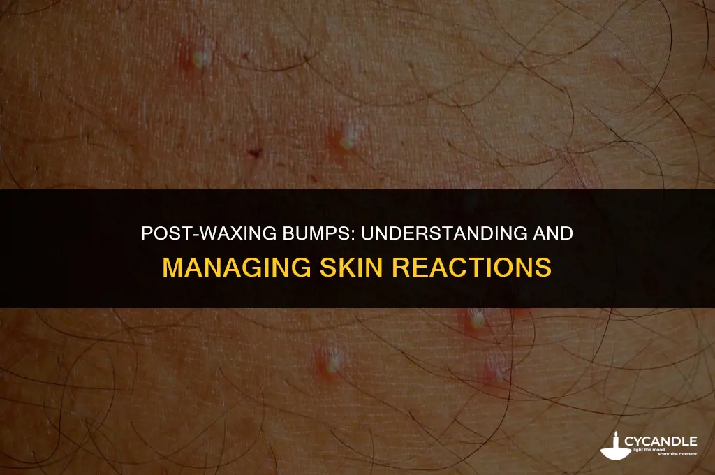 are bumps after waxing normal