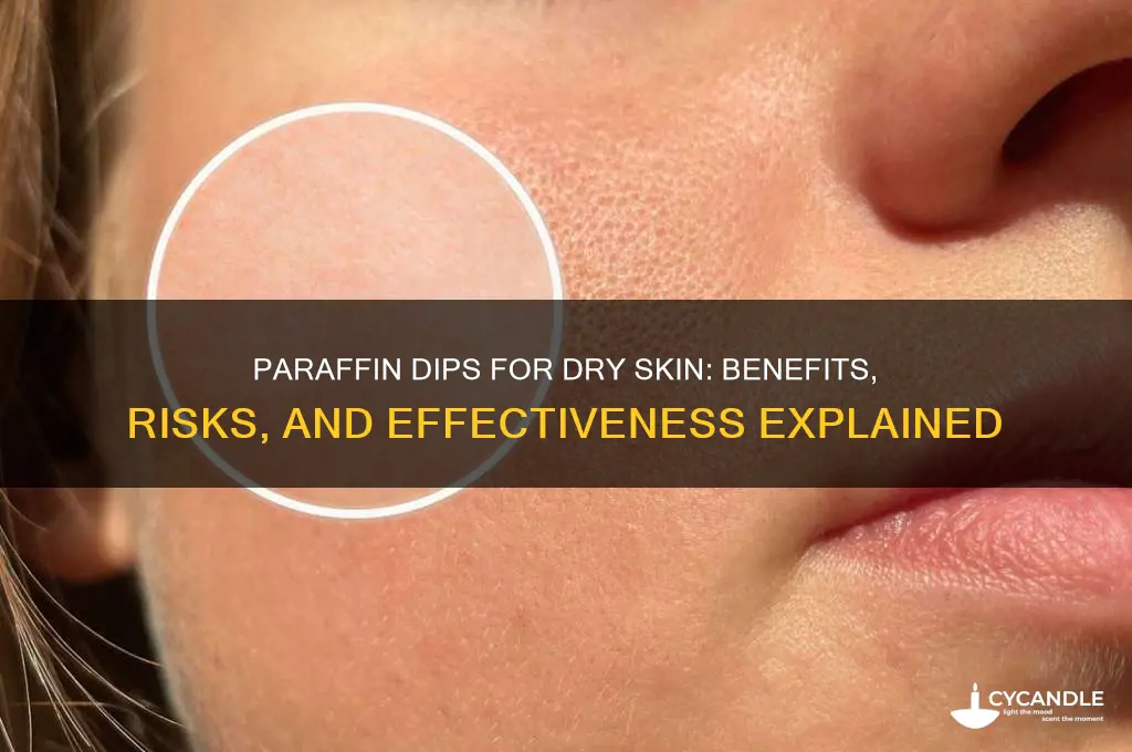 are paraffin dips good for dry skin