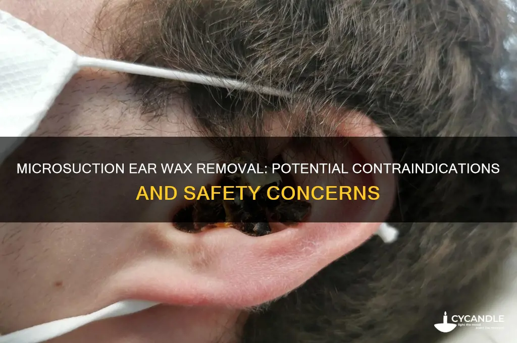 are there any contraindications for microsuction ear wax removal