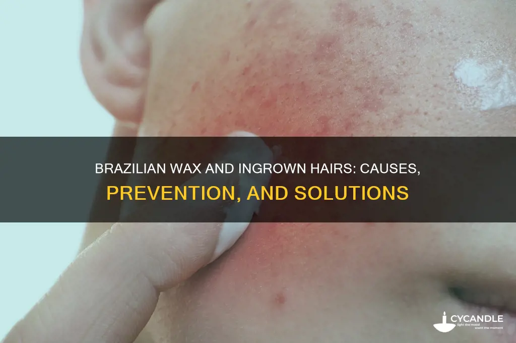 can a brazilian wax cause ingrown hairs