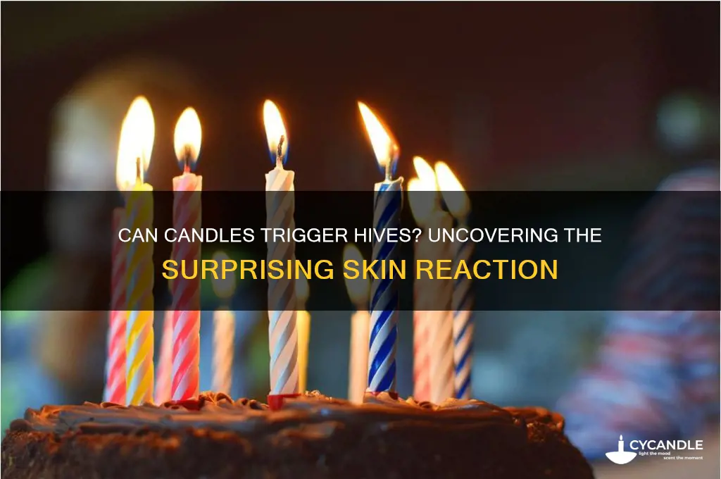 can a candle give you hives