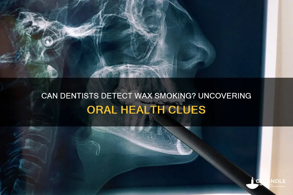 can a dentist tell if you smoke wax