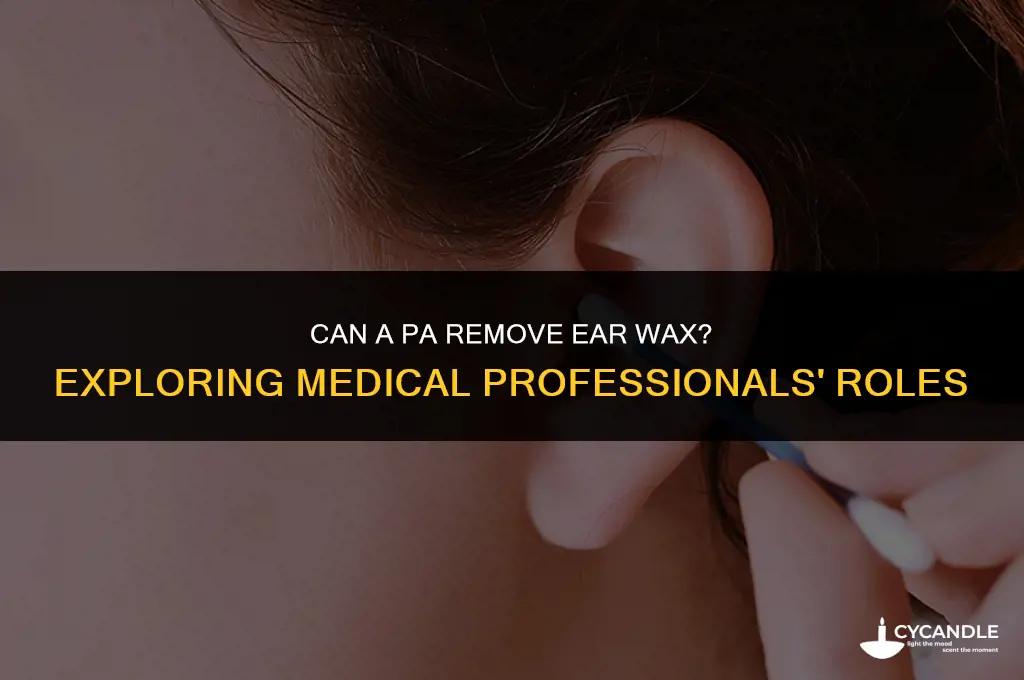 can a pa remove ear wax
