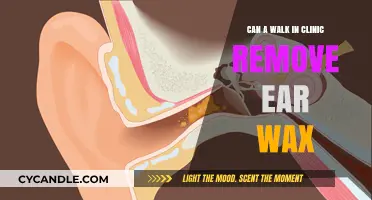 Can Walk-In Clinics Safely Remove Ear Wax? Here's What to Know