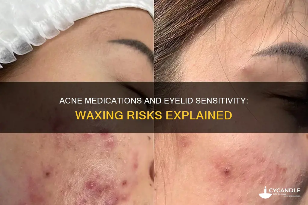 can acne med cause eyelid sensitivity from waxing