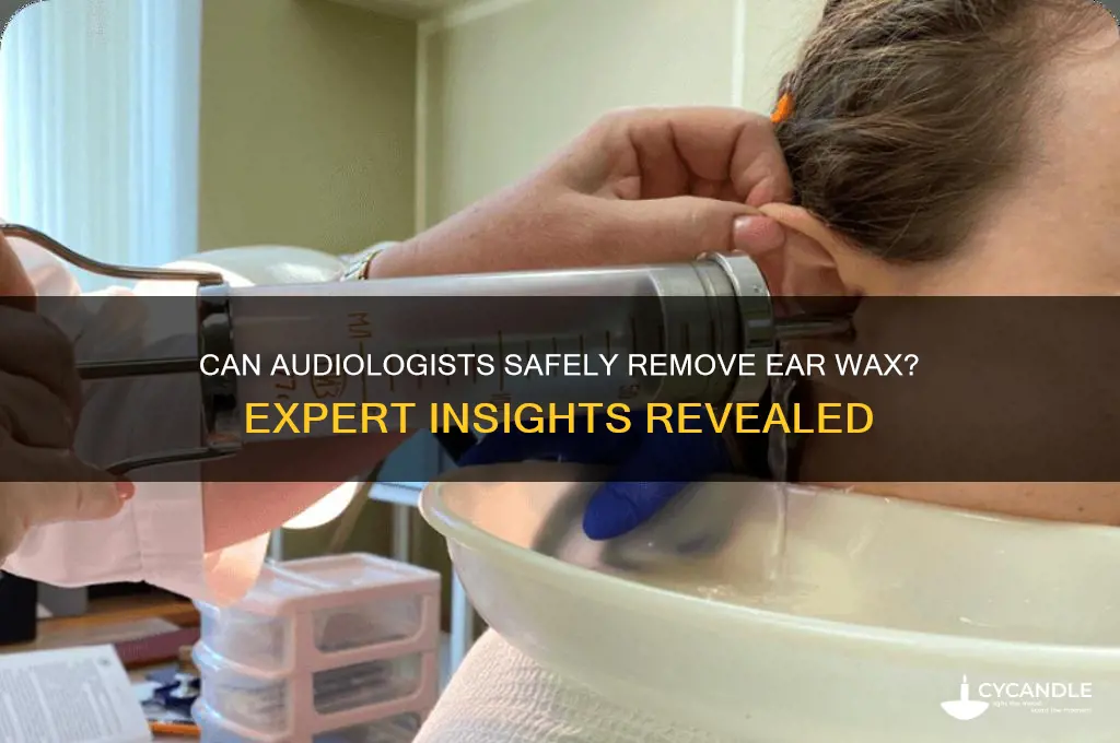 can an audiologist remove ear wax