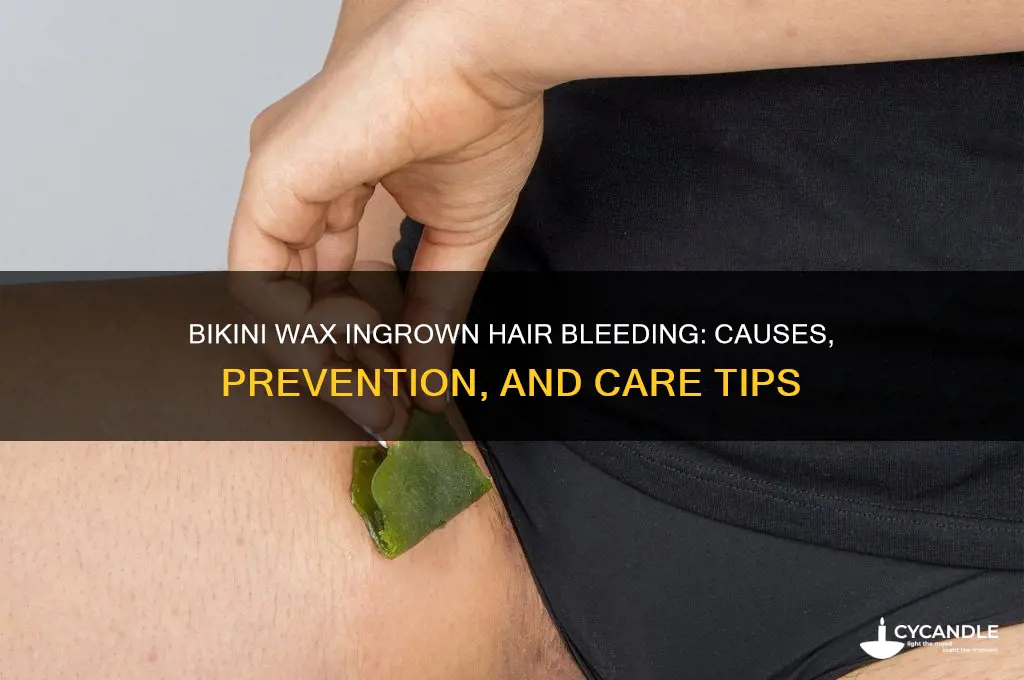 can an ingrown hair from bikini wax bleed
