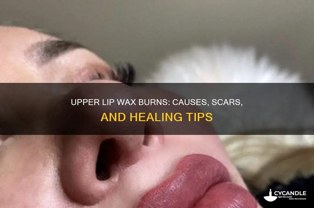 can an upper lip wax burn scar