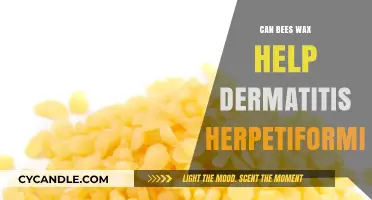 Beeswax for Dermatitis Herpetiformis: Natural Relief or Myth?