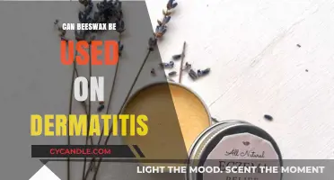 Beeswax for Dermatitis: Natural Relief or Risky Remedy?
