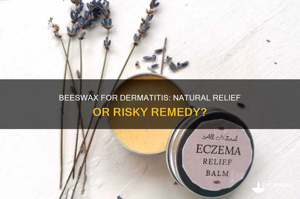 can beeswax be used on dermatitis