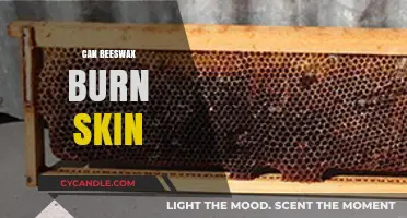 Can Beeswax Burn Skin? Understanding Safety and Proper Use