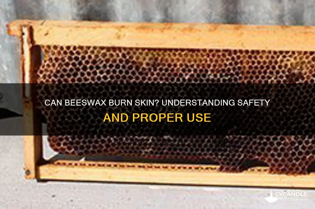 can beeswax burn skin