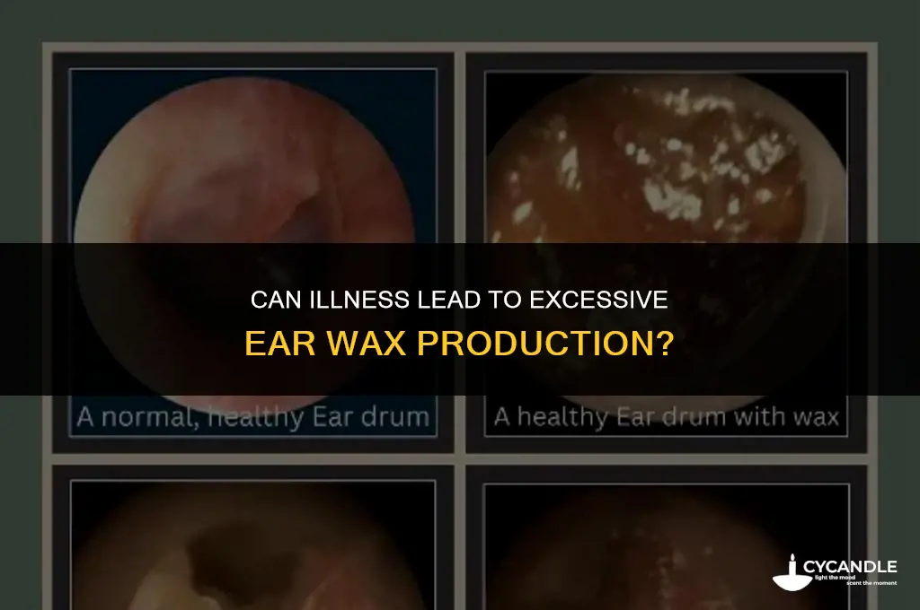 can being sick cause ear wax