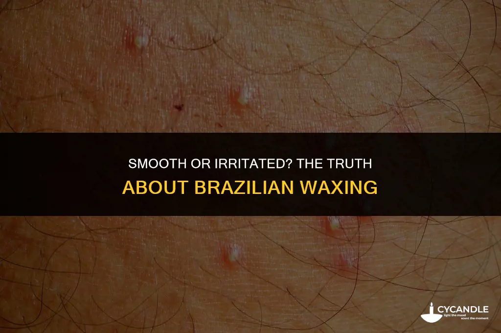 can brazilian wax cause irritation