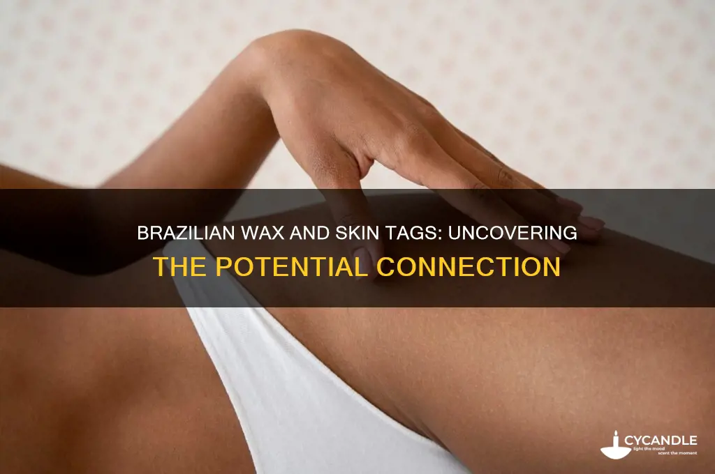 can brazilian wax cause skin tags