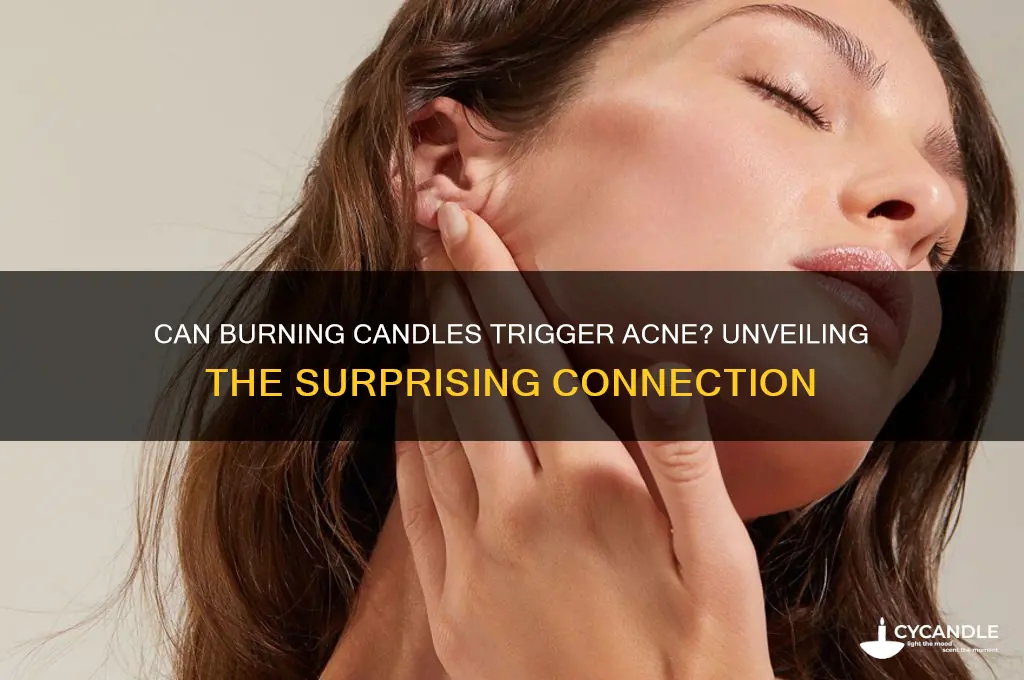can burning candles cause acne