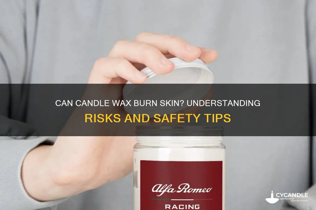 can candle wax burn skin