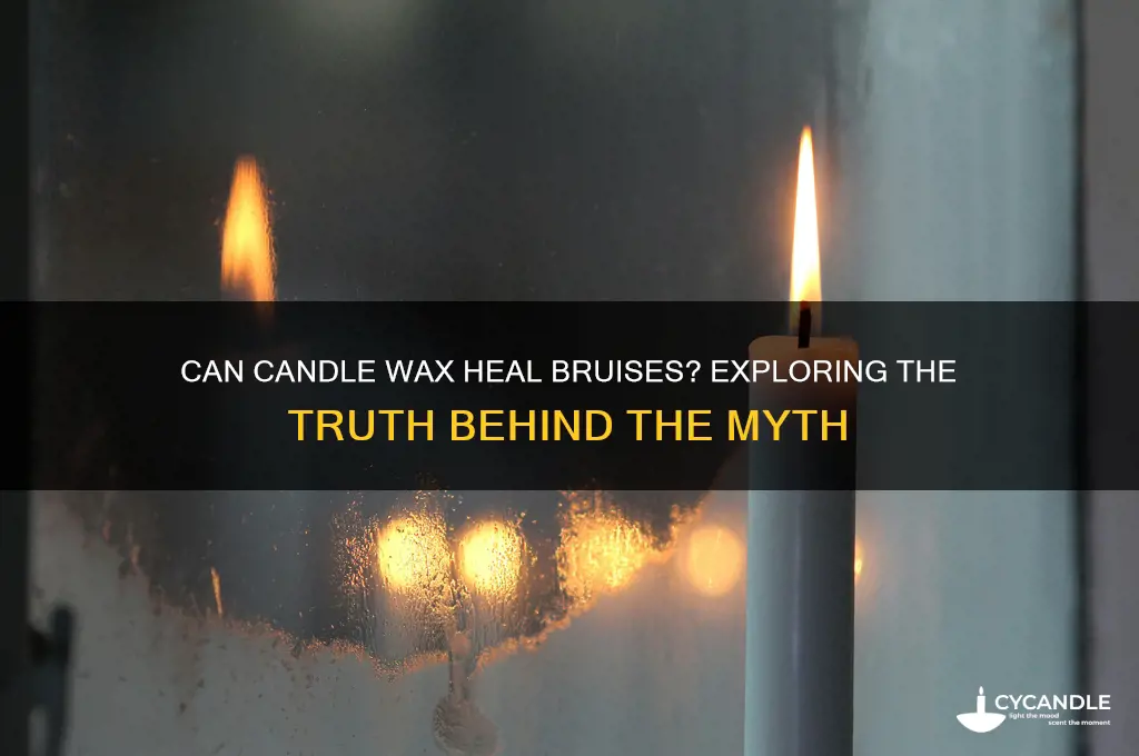 can candle wax heal bruises