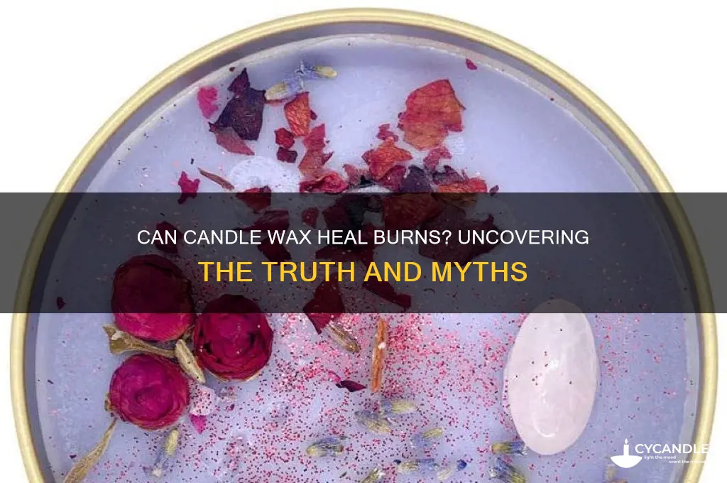 can candle wax heals burns