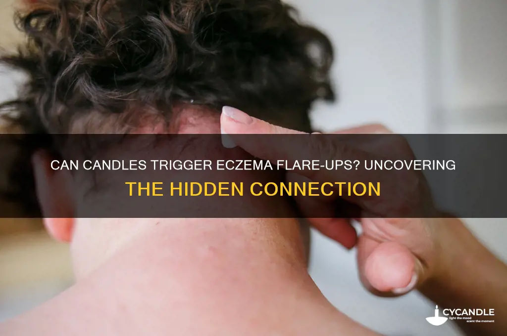 can candles cause eczema