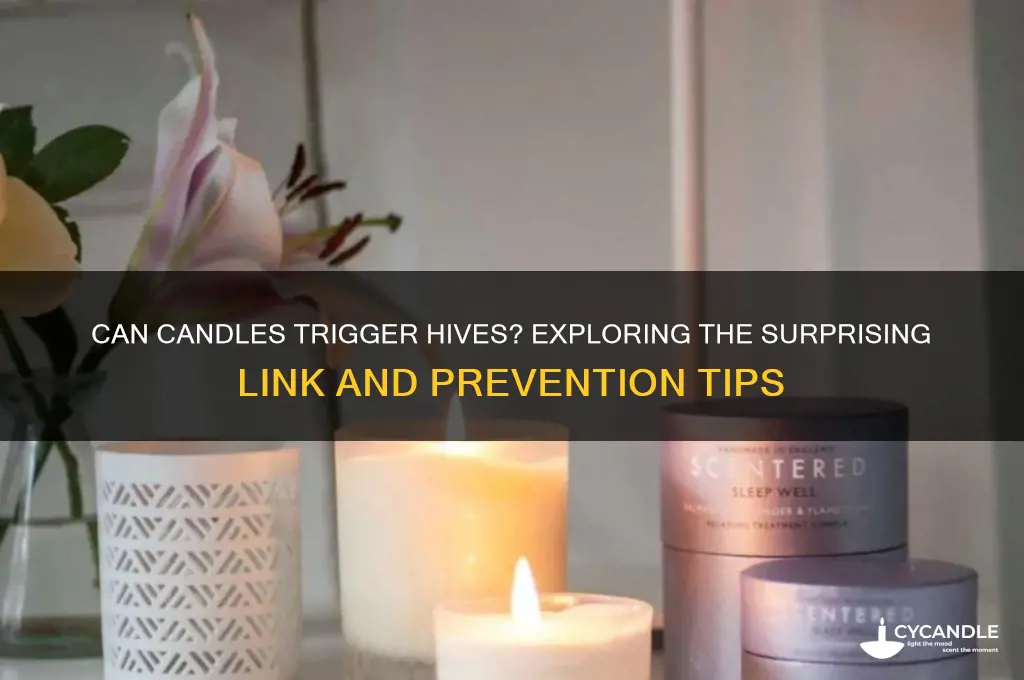 can candles cause hives