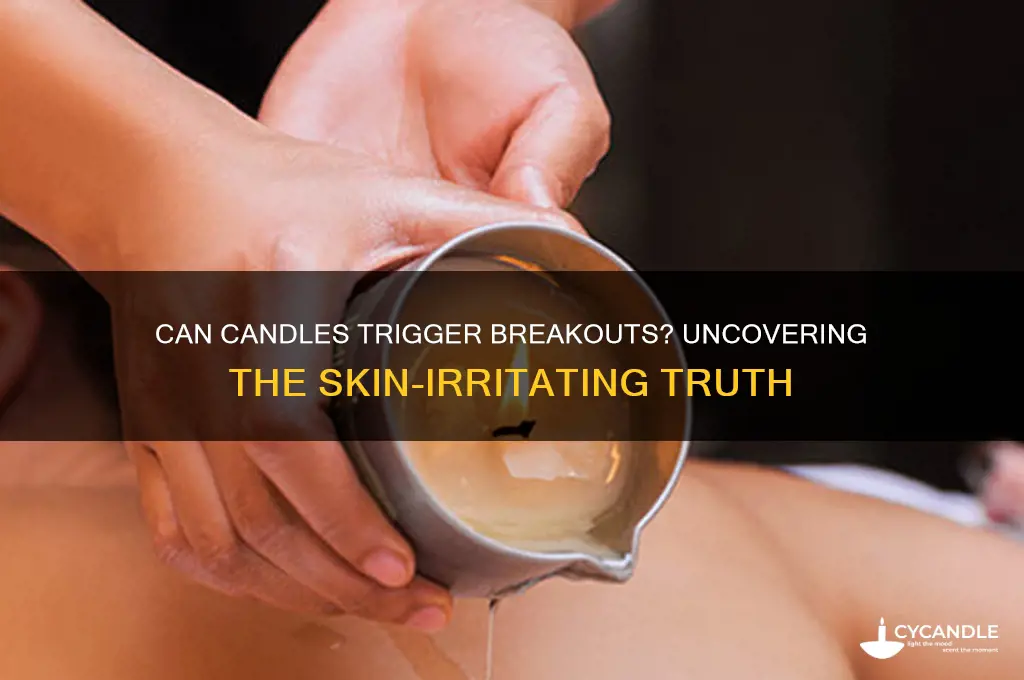 can candles make you break out