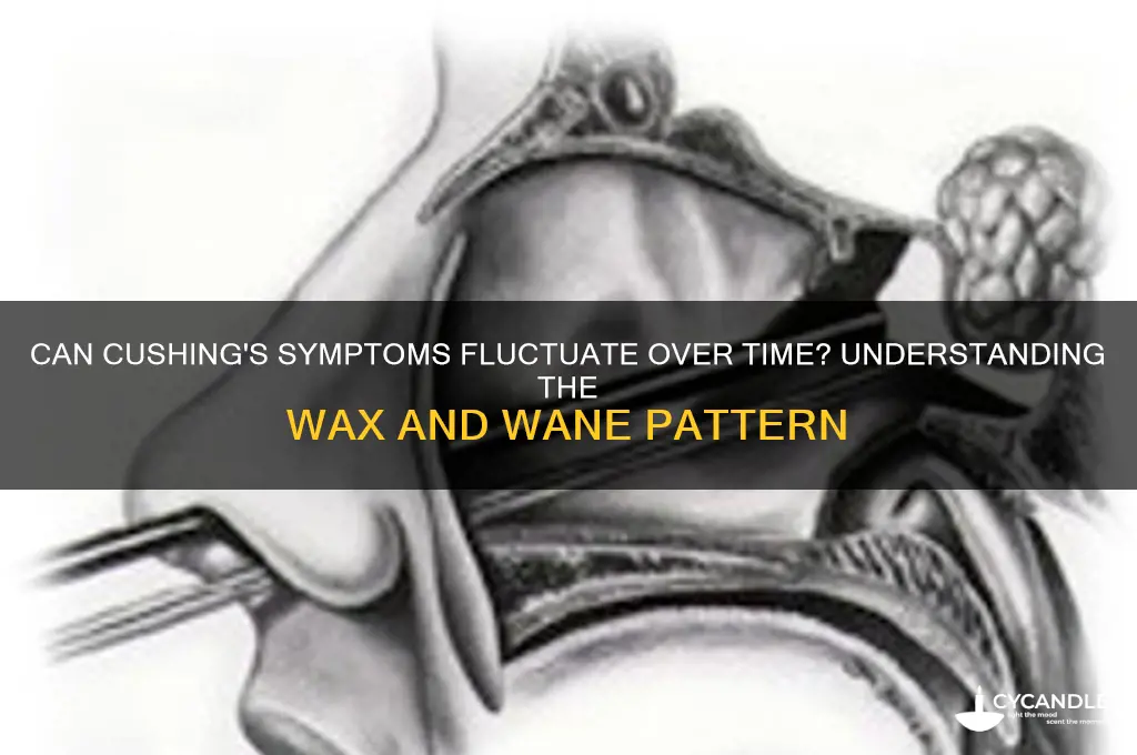 can cushings symptoms wax and wane