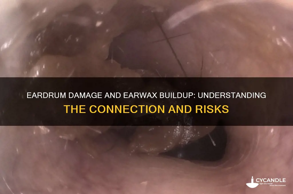 can damage to a eardrum over priudce wax