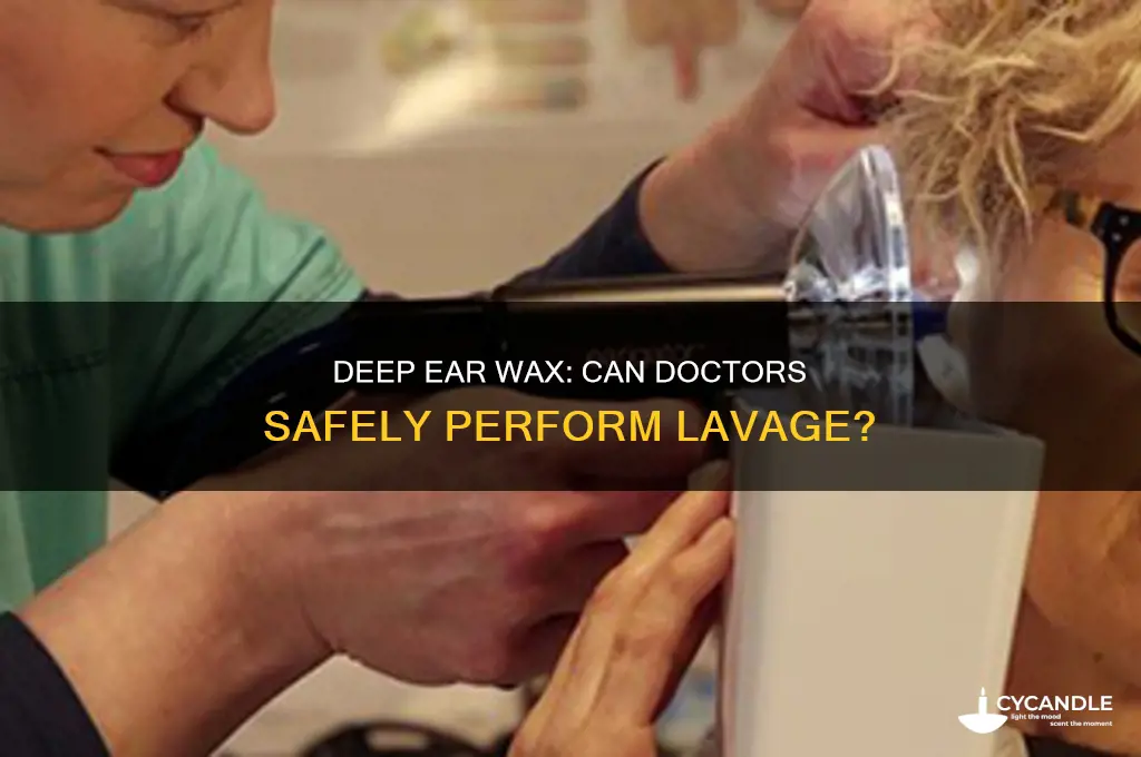 can doctor do ear lavage on really deep wax