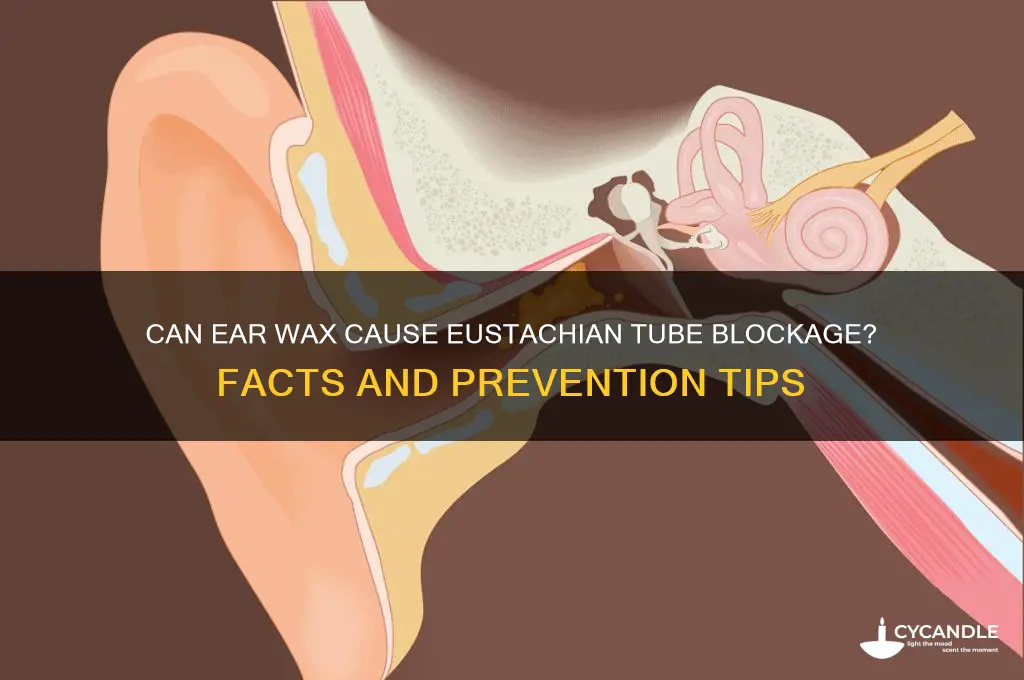 can ea wax block an eustachian tubea