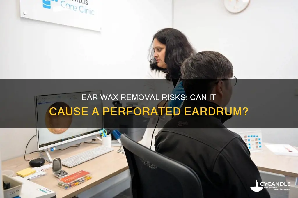 can ear drum be perforated when trying to remove wax