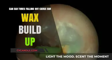 Ear Tubes Falling Out: Link to Ear Wax Buildup Explained