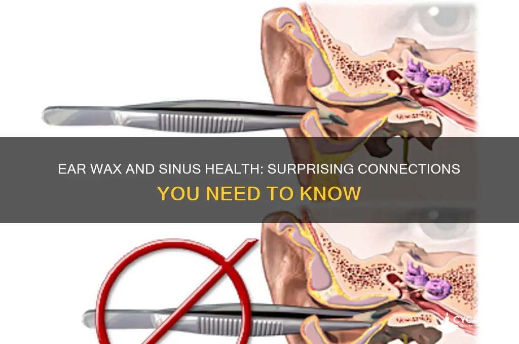 can ear wax affect sinuses