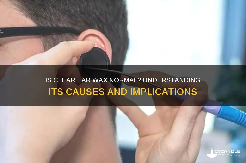can ear wax be clear