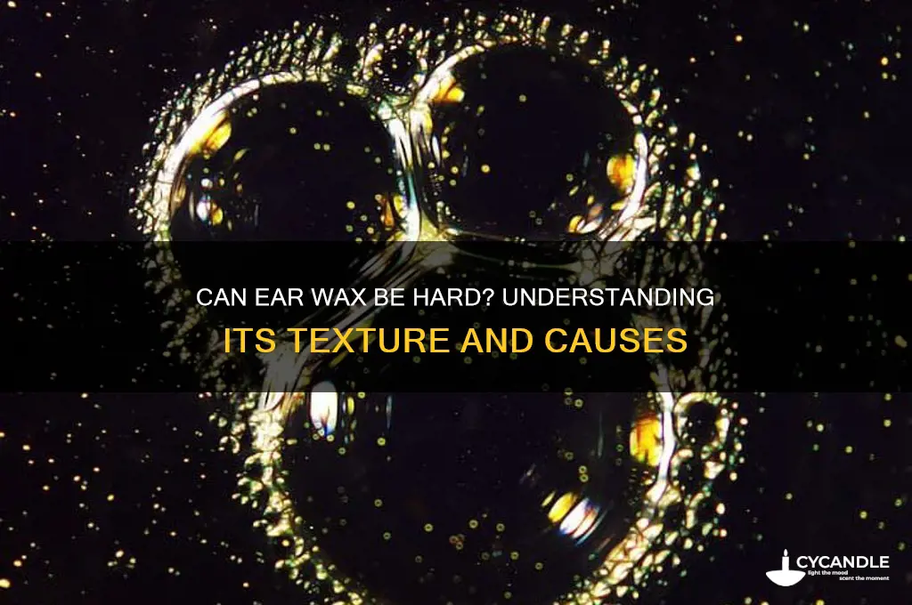 can ear wax be hard