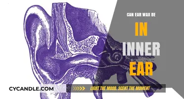 Can Ear Wax Accumulate in the Inner Ear? Facts and Myths