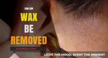 Effective Ways to Safely Remove Ear Wax at Home