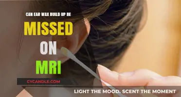 Can Ear Wax Buildup Be Overlooked in MRI Scans?