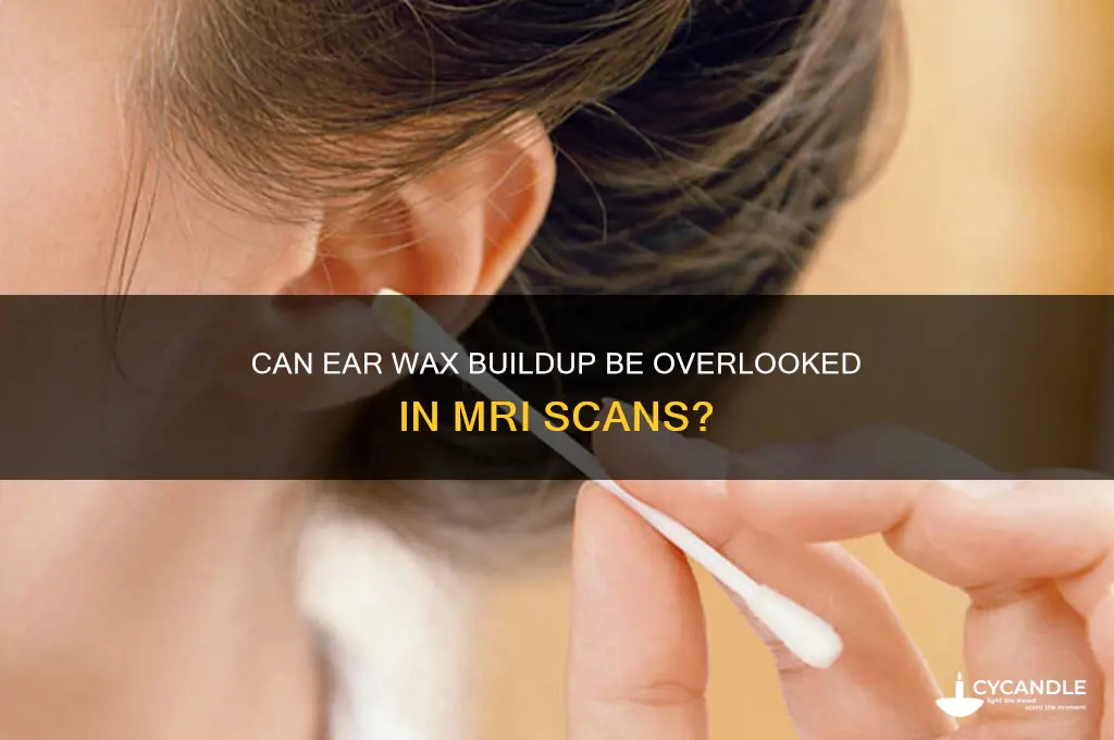 can ear wax build up be missed on mri