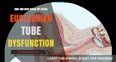 Ear Wax Buildup: A Hidden Cause of Eustachian Tube Dysfunction?