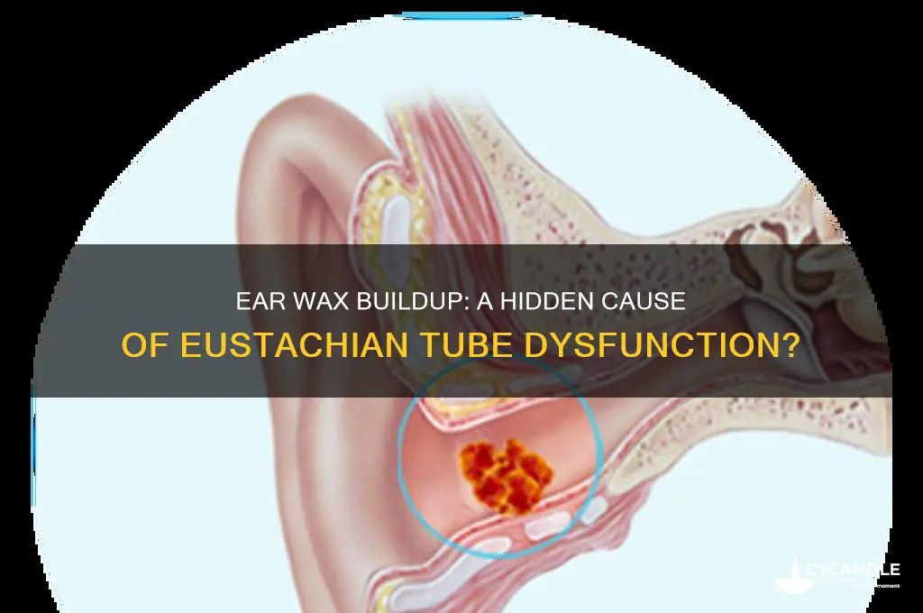 can ear wax build up cause eustachian tube dysfunction
