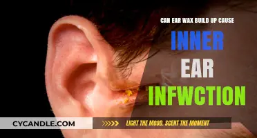 Ear Wax Buildup: A Potential Cause of Inner Ear Infections