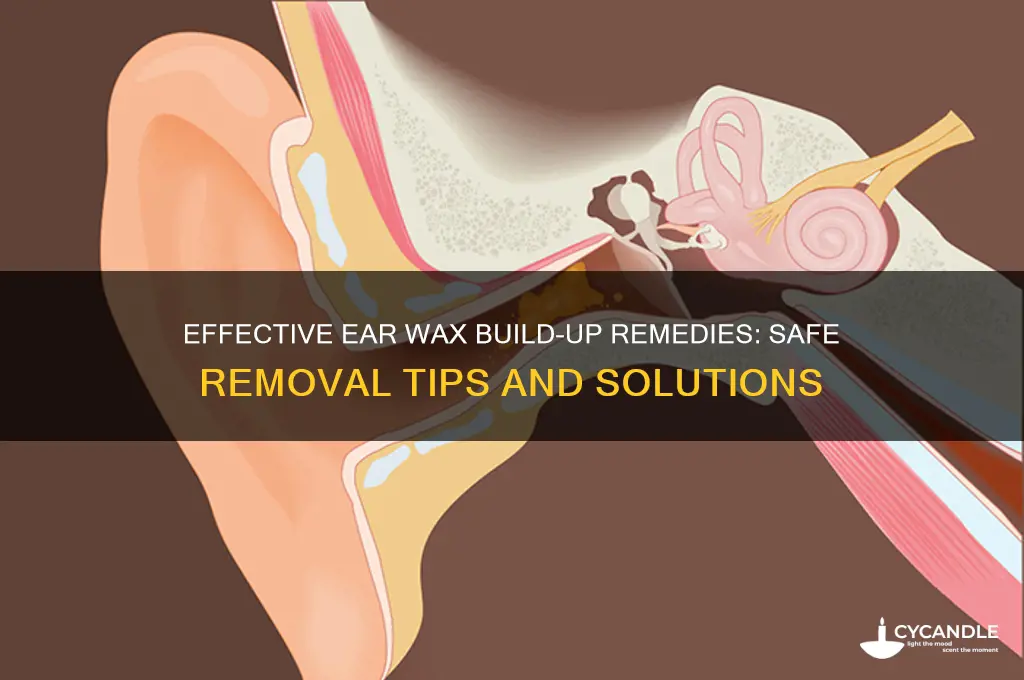 can ear wax build up remedy remove