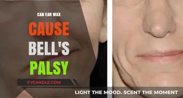 Ear Wax and Bell's Palsy: Unraveling the Surprising Connection