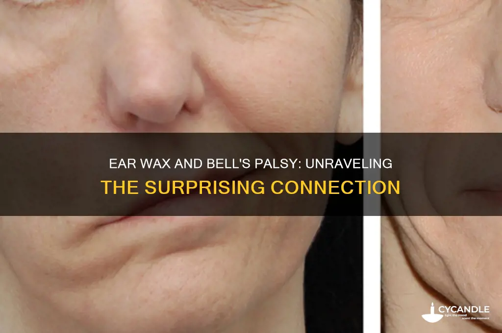 can ear wax cause bell