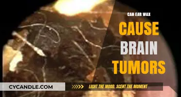 Exploring the Myth: Can Ear Wax Really Cause Brain Tumors?