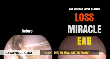 Ear Wax Buildup: Can It Lead to Hearing Loss? Miracle Ear Explains