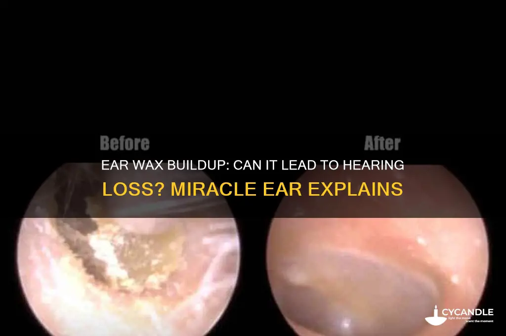 can ear wax cause hearing loss miracle ear